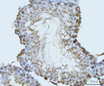 Anti-GHITM Antibody