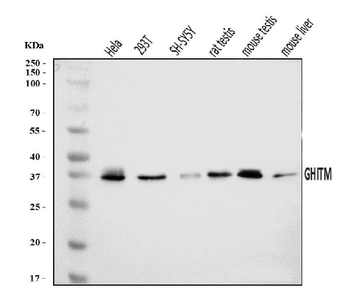 Anti-GHITM Antibody