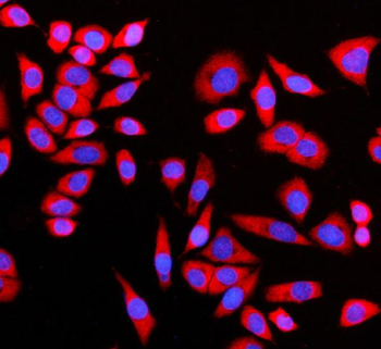 Anti-GIGYF2 Antibody