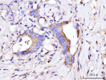 Anti-GIGYF2 Antibody