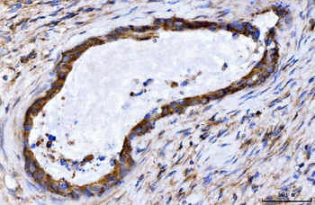 Anti-GIGYF2 Antibody