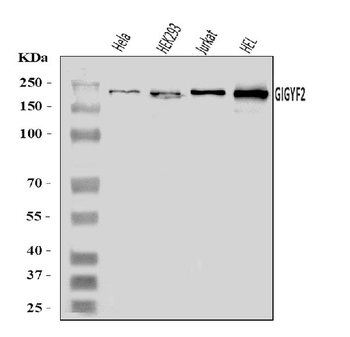 Anti-GIGYF2 Antibody