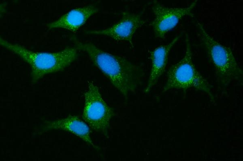 Anti-GIT1 Antibody