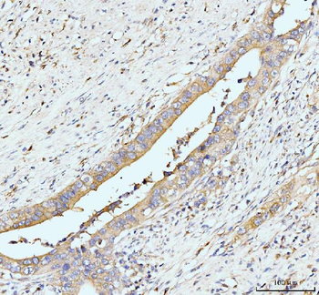 Anti-GIT1 Antibody