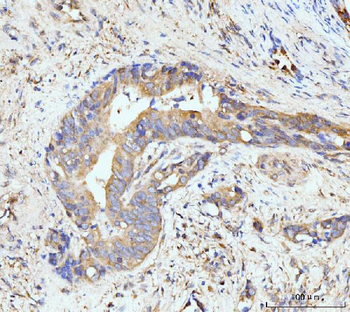 Anti-GIT1 Antibody