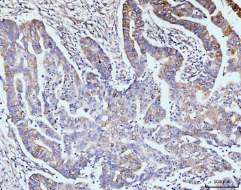 Anti-GIT1 Antibody