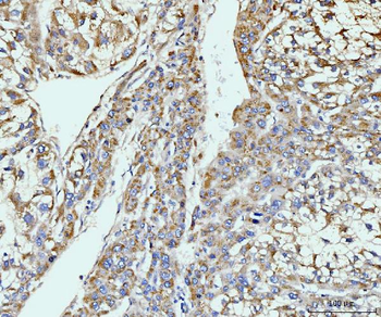 Anti-GIT1 Antibody