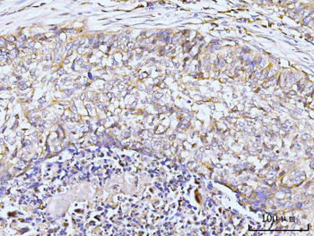 Anti-GIT1 Antibody