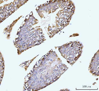 Anti-GIT1 Antibody