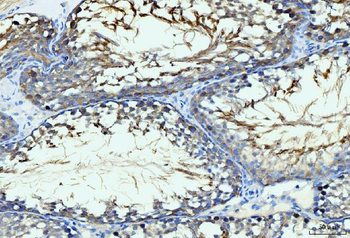 Anti-GIT1 Antibody