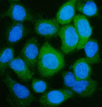 Anti-GLUL Antibody
