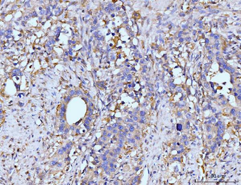 Anti-GLUL Antibody