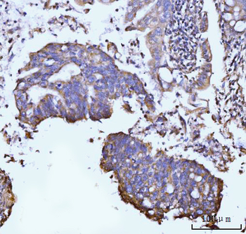 Anti-GLUL Antibody