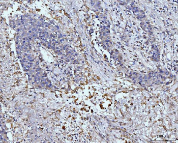 Anti-GLUL Antibody