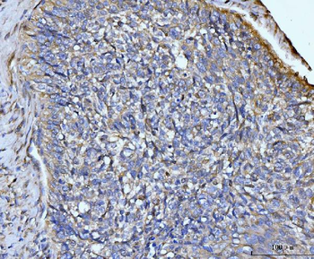 Anti-GLUL Antibody