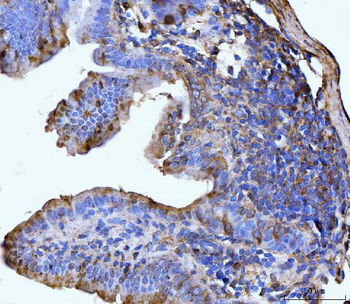 Anti-GLUL Antibody