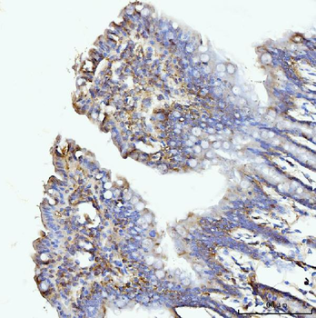 Anti-GLUL Antibody