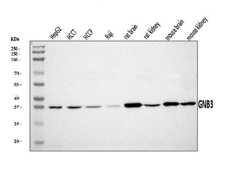 Anti-GNB3 Antibody