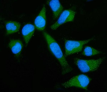Anti-GNB3 Antibody