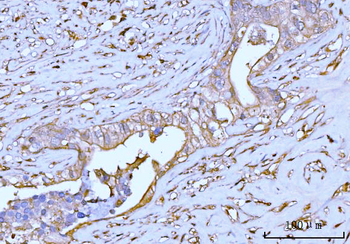 Anti-GNB3 Antibody