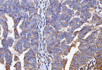 Anti-GNB3 Antibody