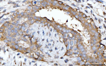 Anti-GNB3 Antibody