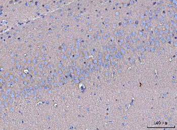Anti-GNB3 Antibody