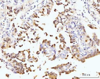 Nucleostemin/GNL3 Antibody