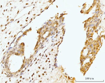 Anti-Nucleostemin/GNL3 Antibody