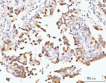 Anti-Nucleostemin/GNL3 Antibody