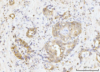 Anti-Nucleostemin/GNL3 Antibody