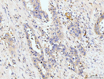 Anti-Golgin 97/GOLGA1 Antibody