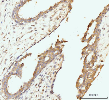 Anti-Golgin 97/GOLGA1 Antibody