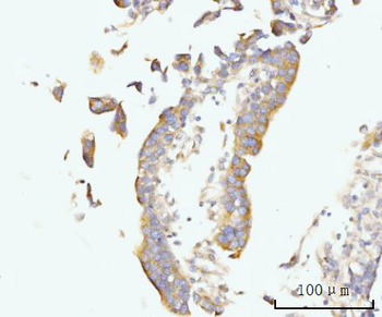 Anti-Golgin 97/GOLGA1 Antibody
