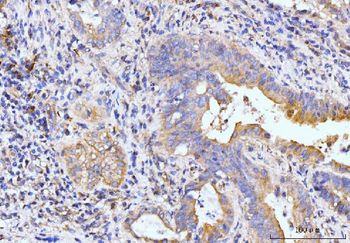 Anti-Golgin 97/GOLGA1 Antibody