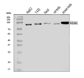 Anti-Golgin 97/GOLGA1 Antibody