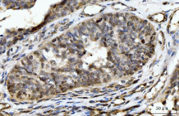 Anti-HES5 Antibody