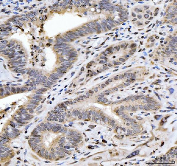 Anti-HES5 Antibody