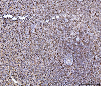 Anti-HES5 Antibody
