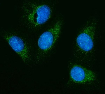 HEXA Antibody