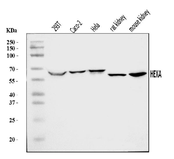 HEXA Antibody
