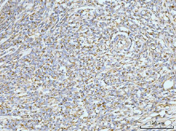 Anti-GRPEL1 Antibody