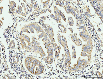 Anti-GRPEL1 Antibody