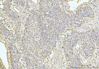 Anti-GRPEL1 Antibody