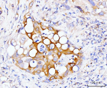 Anti-GSPT1,2 Antibody