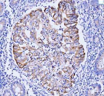Anti-GSPT1,2 Antibody