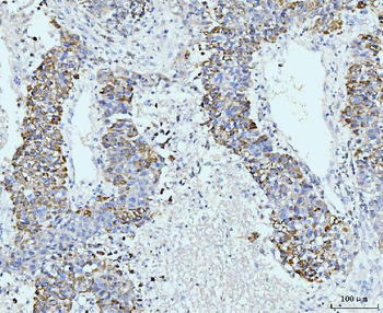 Anti-GSPT1,2 Antibody