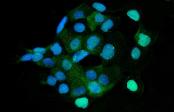 Anti-HMGCS1 Antibody