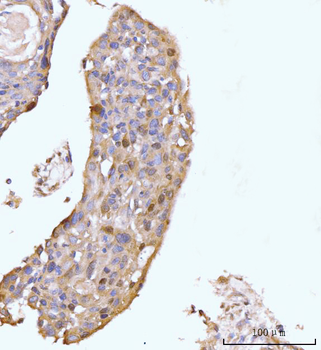 Anti-HMGCS1 Antibody