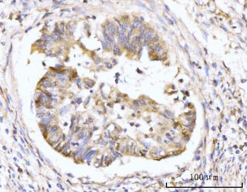 Anti-HMGCS1 Antibody
